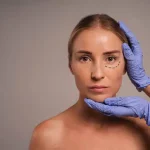 Eyelid Surgery in Delhi – Dr Rajat Gupta