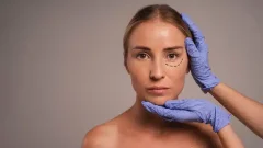 Eyelid Surgery in Delhi – Dr Rajat Gupta