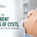 What Are the Types of Cysts, and How Can They Be Treated?